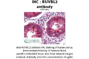Image no. 3 for anti-RuvB-Like 2 (E. Coli) (RUVBL2) (AA 304-458) antibody (ABIN1738977)