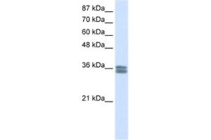 Image no. 1 for anti-Calcium Channel, Voltage-Dependent, gamma Subunit 4 (CACNG4) antibody (ABIN2461575)