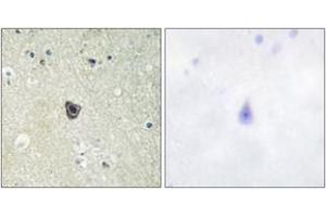 Image no. 1 for anti-Colony Stimulating Factor 1 Receptor (CSF1R) (AA 781-830) antibody (ABIN1532577)
