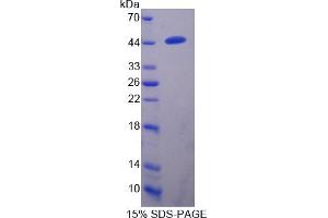 Image no. 1 for Transmembrane Protease, serine 4 (TMPRSS4) (AA 54-437) protein (His tag) (ABIN6237124)