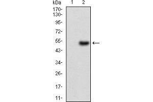 Image no. 3 for anti-Wilms Tumor 1 (WT1) (AA 314-479) antibody (ABIN5684073)