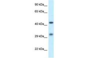 Image no. 1 for anti-Scavenger Receptor Class B, Member 2 (SCARB2) (AA 25-74) antibody (ABIN6749778)