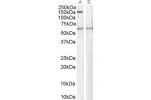 Image no. 1 for anti-Signal-Induced Proliferation-Associated 1 (SIPA1) (C-Term) antibody (ABIN185175)