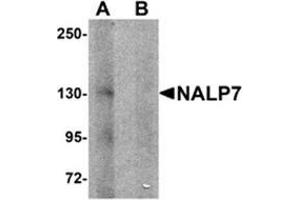 Image no. 1 for anti-NLR Family, Pyrin Domain Containing 7 (NLRP7) (N-Term) antibody (ABIN783711)