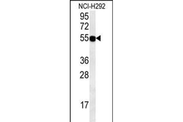ZNF492 抗体  (C-Term)