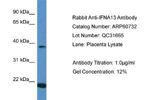 Image no. 1 for anti-Interferon, alpha 13 (IFNA13) (C-Term) antibody (ABIN2788553)
