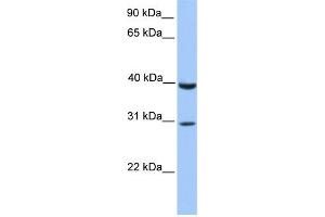 Image no. 1 for anti-JAZF Zinc Finger 1 (JAZF1) (C-Term) antibody (ABIN2778568)