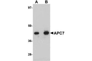 Image no. 1 for anti-Anaphase Promoting Complex Subunit 7 (ANAPC7) (C-Term) antibody (ABIN499303)