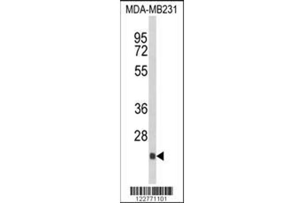 anti-Der1-Like Domain Family, Member 2 (DERL2) (AA 191-218), (C-Term) antibody