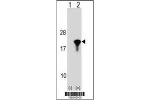 Image no. 2 for anti-Peptidylprolyl Isomerase (Cyclophilin)-Like 1 (PPIL1) (AA 63-91) antibody (ABIN1538539)