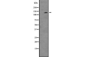 Image no. 1 for anti-tau Tubulin Kinase 2 (TTBK2) (C-Term) antibody (ABIN6258666)