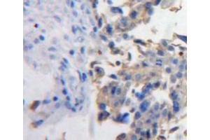 Used in DAB staining on fromalin fixed paraffin-embedded ovary tissue