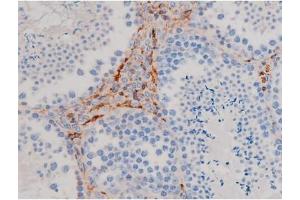 Image no. 1 for anti-V-Akt Murine Thymoma Viral Oncogene Homolog 1 (AKT1) (pSer124) antibody (ABIN6256119)