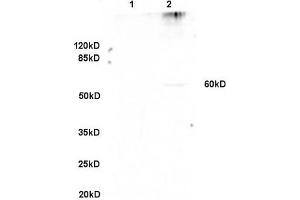 Image no. 1 for anti-Osteoactivin (GPNMB) (AA 81-180) antibody (ABIN749093)