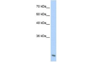 Image no. 1 for anti-Amino-terminal Enhancer of Split (AES) (C-Term) antibody (ABIN629632)