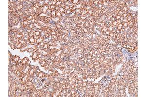 Image no. 2 for anti-V-Raf Murine Sarcoma 3611 Viral Oncogene Homolog (ARAF) (pSer299) antibody (ABIN6271430)