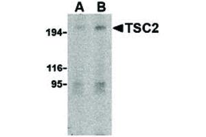 Image no. 1 for anti-Tuberous Sclerosis 2 (TSC2) (N-Term) antibody (ABIN6655755)