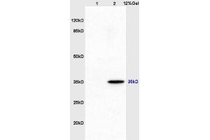Image no. 2 for anti-Aminoacyl tRNA Synthetase Complex-Interacting Multifunctional Protein 2 (AIMP2) (AA 201-300) antibody (ABIN741300)