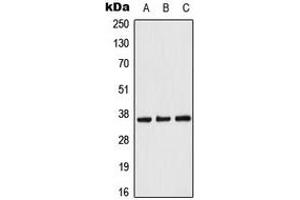 Image no. 3 for anti-Acyl-CoA Thioesterase 8 (ACOT8) (Center) antibody (ABIN2705392)