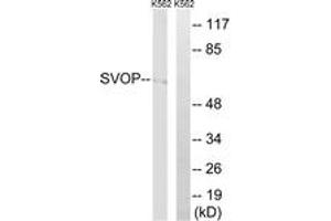 Image no. 1 for anti-Synaptic Vesicle 2-Related Protein (SVOP) (AA 271-320) antibody (ABIN1535403)