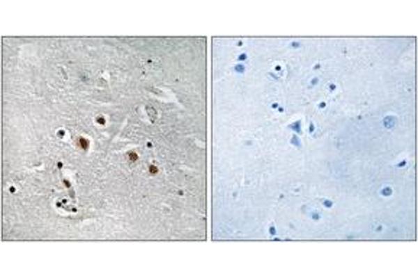 MED13L antibody  (AA 449-498)
