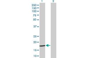 Western Blot analysis of NPC2 expression in transfected 293T cell line by NPC2 MaxPab polyclonal antibody.