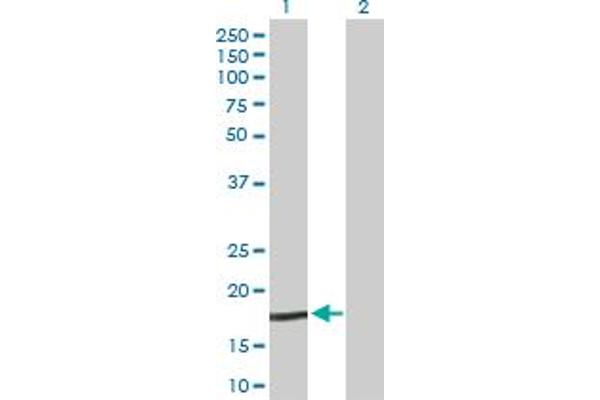 NPC2 Antikörper  (AA 1-151)