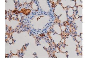 Image no. 2 for anti-V-Akt Murine Thymoma Viral Oncogene Homolog 1 (AKT1) (pSer124) antibody (ABIN6256119)