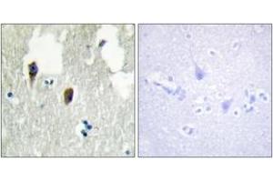 Image no. 1 for anti-Kelch-Like 3 (KLHL3) (AA 10-59) antibody (ABIN1534174)