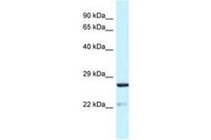Image no. 1 for anti-Yip1 Domain Family, Member 5 (YIPF5) (AA 54-103) antibody (ABIN6747764)