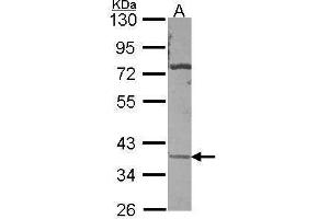 CA11 anticorps  (Center)