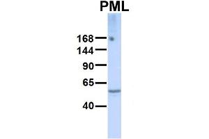 Image no. 4 for anti-Promyelocytic Leukemia (PML) (Middle Region) antibody (ABIN2778427)