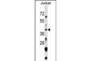 Image no. 1 for anti-Small Nuclear RNA Activating Complex, Polypeptide 1, 43kDa (SNAPC1) (AA 139-168) antibody (ABIN5537362)