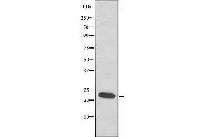Image no. 1 for anti-Leucine Zipper, Down-Regulated in Cancer 1-Like (LDOC1L) antibody (ABIN6259053)