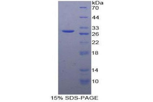 GFP Protein (AA 1-238) (His tag)