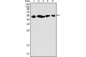 Image no. 3 for anti-Keratin 8 (KRT8) (AA 391-483) antibody (ABIN969080)