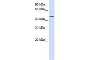 RGS11 antibody  (AA 360-409)