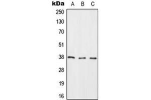 Image no. 1 for anti-Ras Association (RalGDS/AF-6) Domain Family Member 2 (RASSF2) (Center) antibody (ABIN2706932)