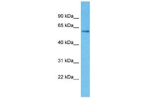 Image no. 1 for anti-Kelch-Like 3 (KLHL3) (N-Term) antibody (ABIN2776039)
