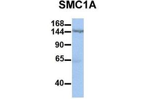 Image no. 2 for anti-Structural Maintenance of Chromosomes 1A (SMC1A) (C-Term) antibody (ABIN2780766)