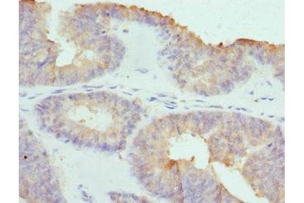 COCH antibody  (AA 20-260)