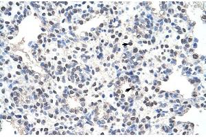 Image no. 2 for anti-Nucleolin (NCL) (N-Term) antibody (ABIN2778935)