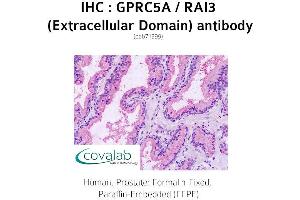 Image no. 1 for anti-G Protein-Coupled Receptor, Family C, Group 5, Member A (GPRC5A) (2nd Extracellular Domain) antibody (ABIN1735207)