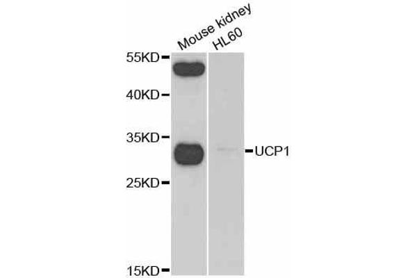UCP1 抗体  (AA 1-307)