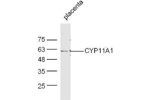 Image no. 1 for anti-Cytochrome P450, Family 11, Subfamily A, Polypeptide 1 (CYP11A1) (AA 321-420) antibody (ABIN701530)
