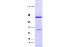 Image no. 1 for Protein tyrosine Phosphatase, Non-Receptor Type 1 (PTPN1) protein (DYKDDDDK Tag) (ABIN2730105)