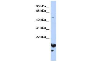 Image no. 1 for anti-Nucleolar and Spindle Associated Protein 1 (NUSAP1) (Middle Region) antibody (ABIN630728)