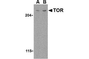 Image no. 1 for anti-RAR-Related Orphan Receptor C (RORC) (N-Term) antibody (ABIN1031636)