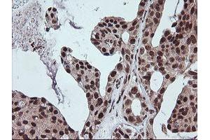 Image no. 2 for anti-Fetal and Adult Testis Expressed 1 (FATE1) antibody (ABIN1498222)