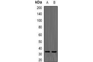 Image no. 2 for anti-Thiopurine S-Methyltransferase (TPMT) antibody (ABIN2967103)